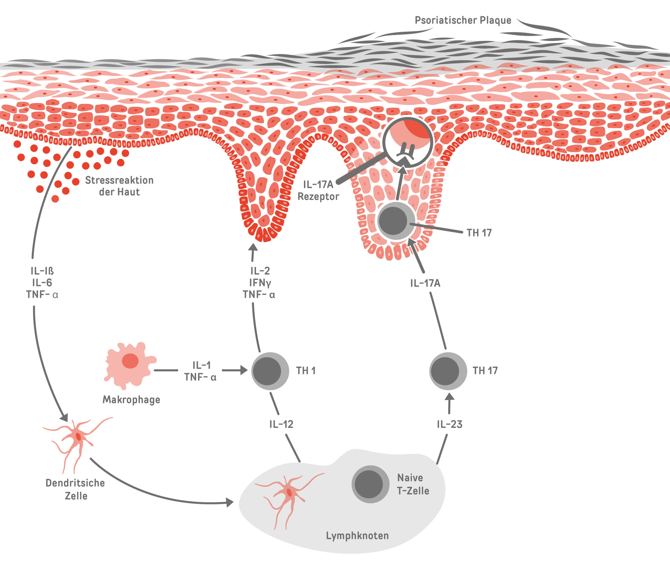 Psoriasis-Therapie mit Biologika