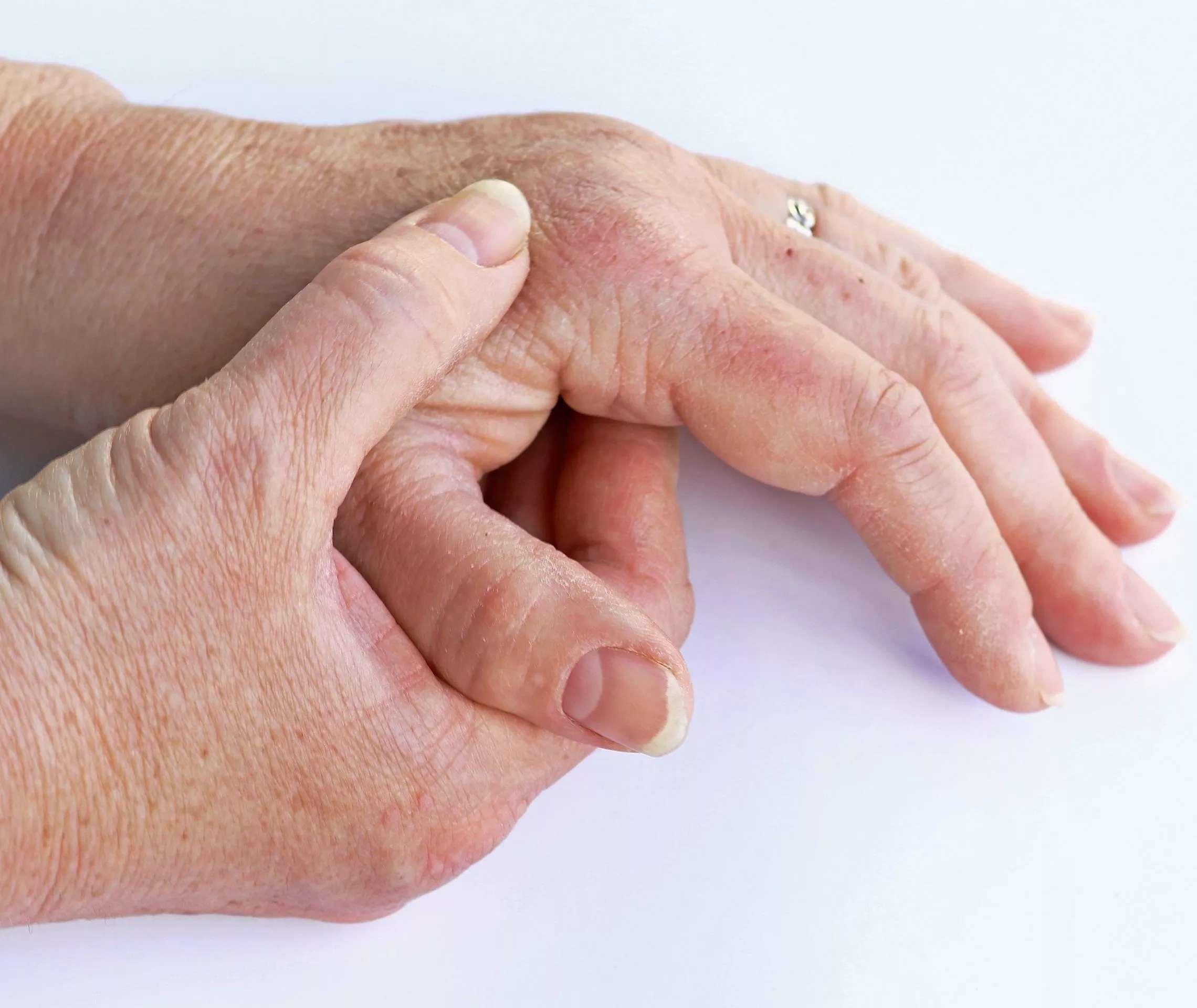 Möglichkeiten der Diagnose bei Gelenkbeschwerden