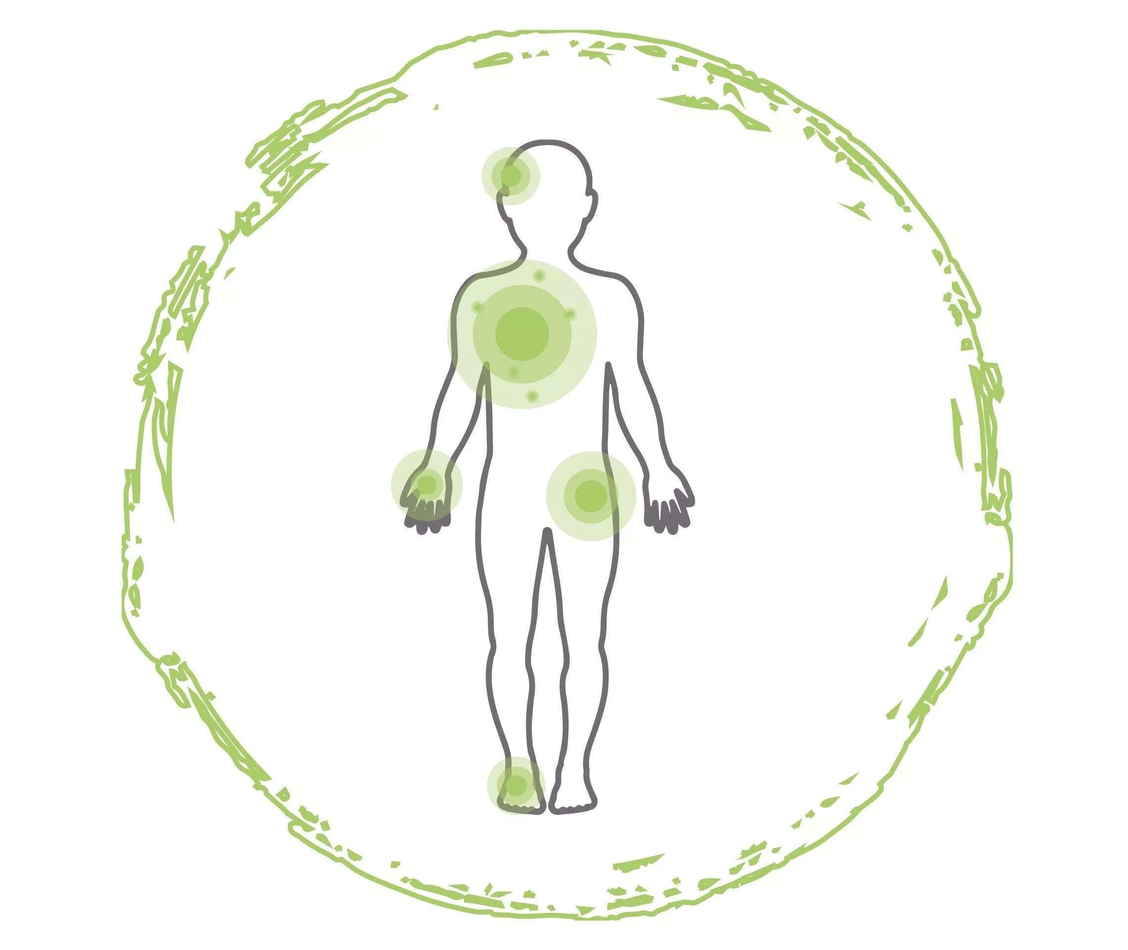 Troepfchenfoermige Psoriasis