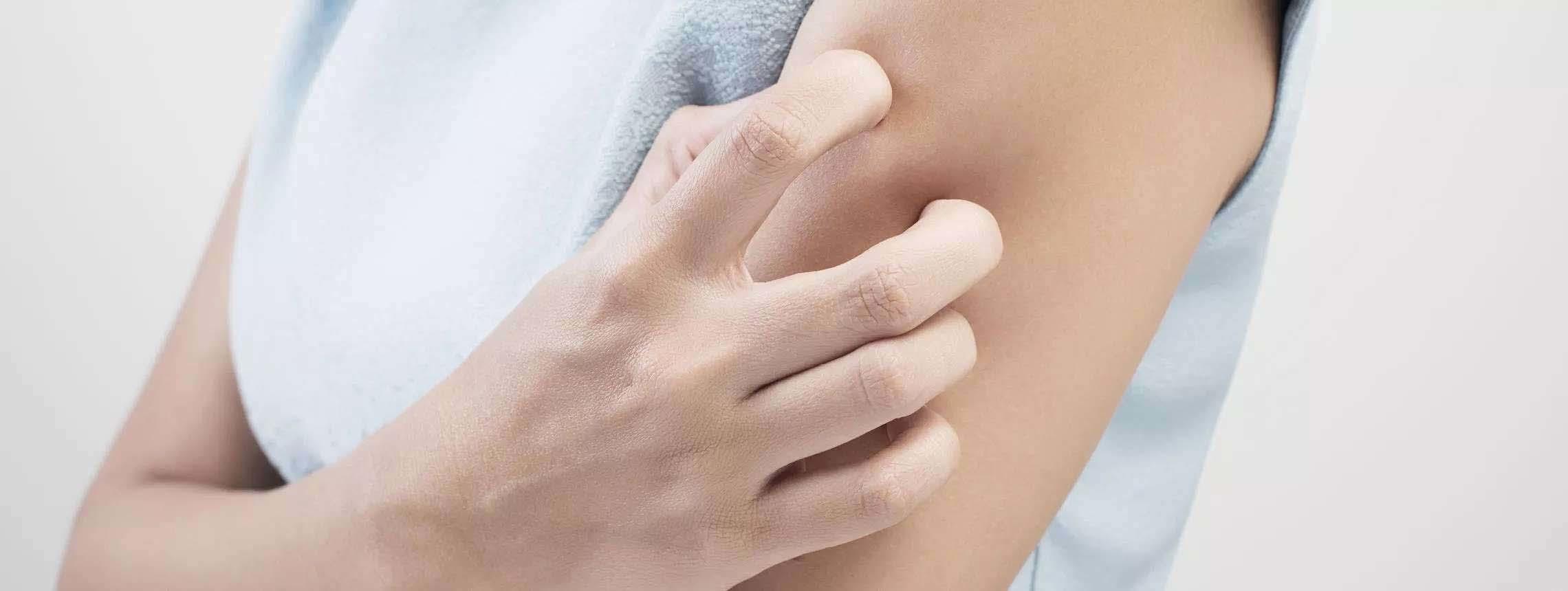 Psoriasis-Betroffene kratzt sich am Oberarm